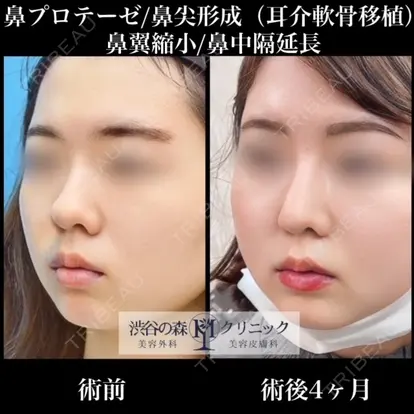 冨田 祥一先生の症例