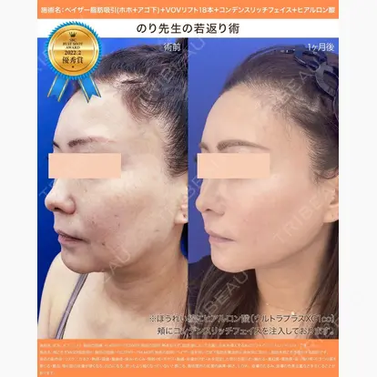 伊藤賀敏先生の症例