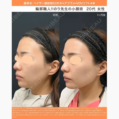 伊藤賀敏先生の症例