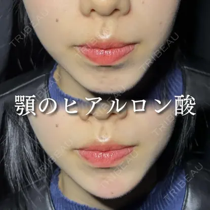 成田 央良先生の症例