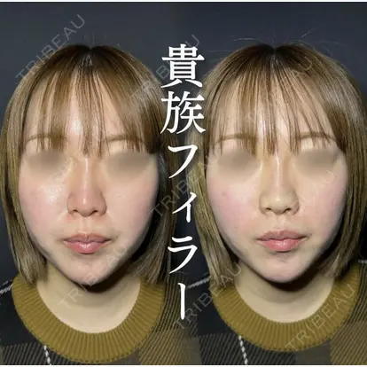 成田 央良先生の症例