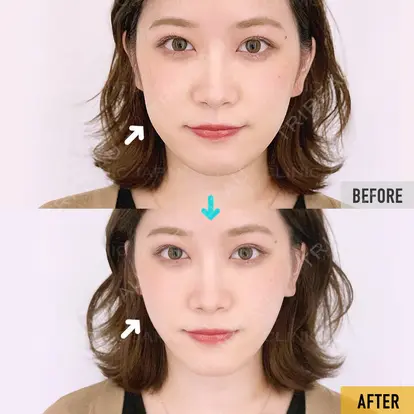 柴田 貴志先生の症例