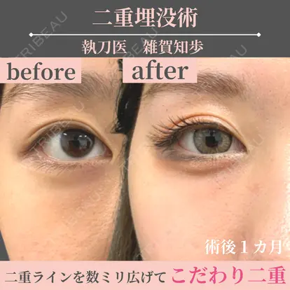 雑賀知歩先生の症例