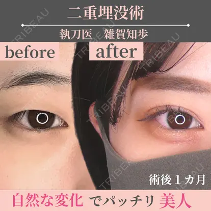 雑賀知歩先生の症例