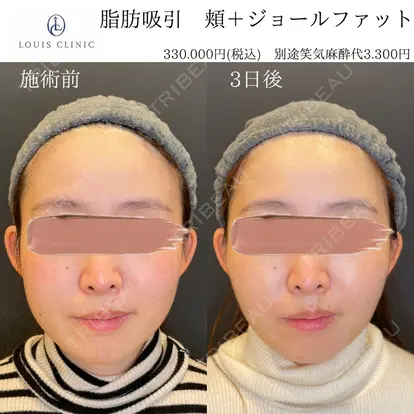 小松 塁先生の症例