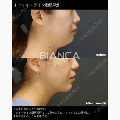 堀田 和亮先生の症例