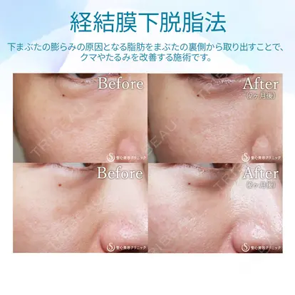伊藤 哲郎先生の症例