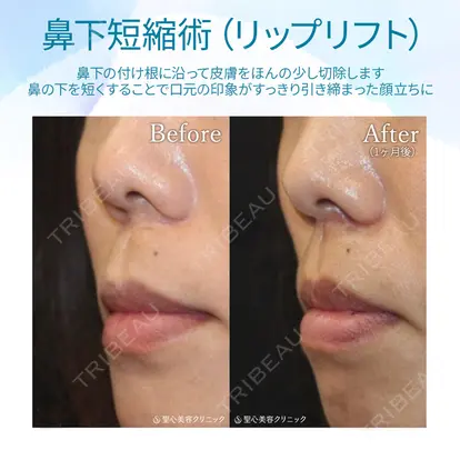 牧野 陽二郎先生の症例