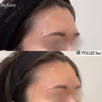 山中大介先生の症例