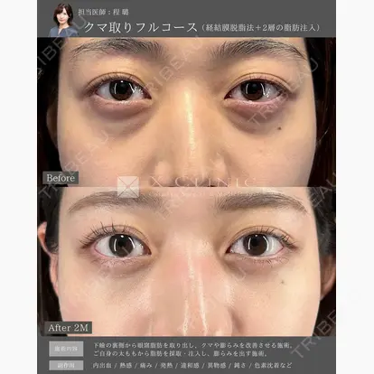 程 璐先生の症例