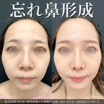 吉原 伯先生の症例