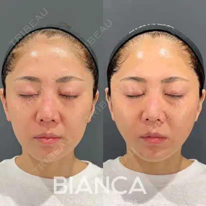 服部 有美先生の症例