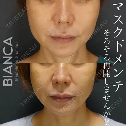 服部 有美先生の症例