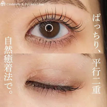 岩井稜先生の症例