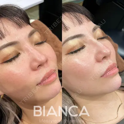 服部 有美先生の症例