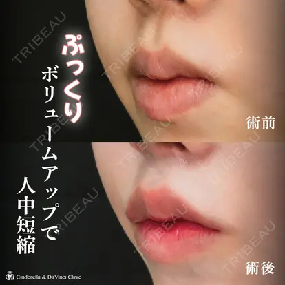 岩井稜先生の症例