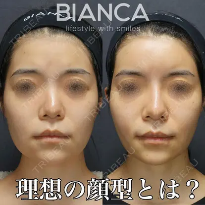 服部 有美先生の症例