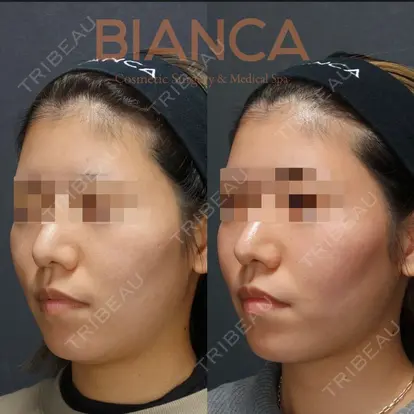 服部 有美先生の症例