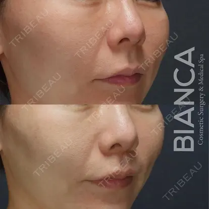 服部 有美先生の症例