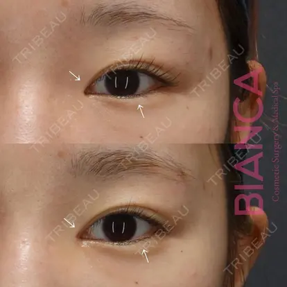 服部 有美先生の症例