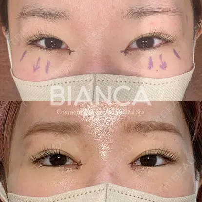 服部 有美先生の症例