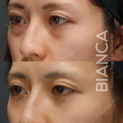 服部 有美先生の症例