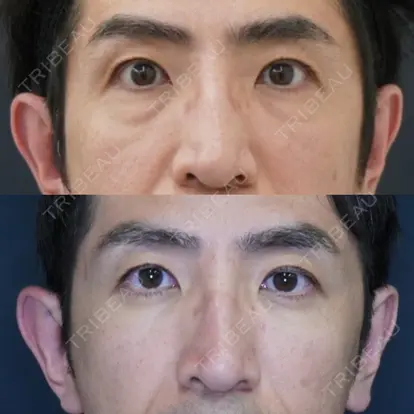 野口 道男先生の症例
