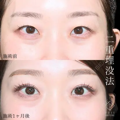 小川 杏平先生の症例