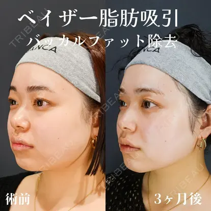 池田 雪太郎先生の症例