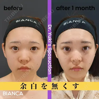 池田 雪太郎先生の症例