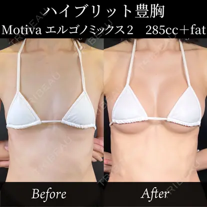 中西 友莉先生の症例