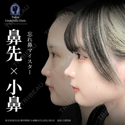 吉原 伯先生の症例