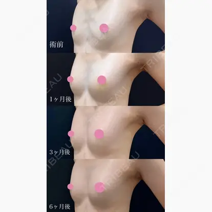 宜保 智樹先生の症例
