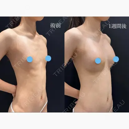 宜保 智樹先生の症例
