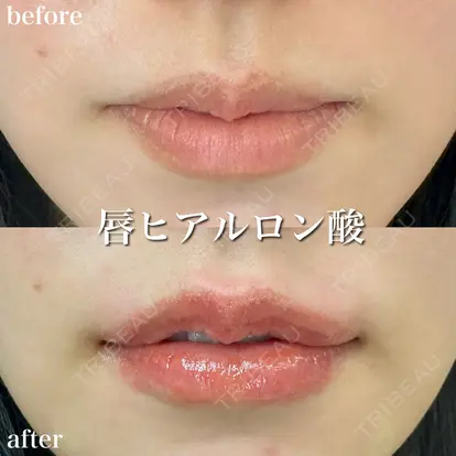 小松 正樹先生の症例