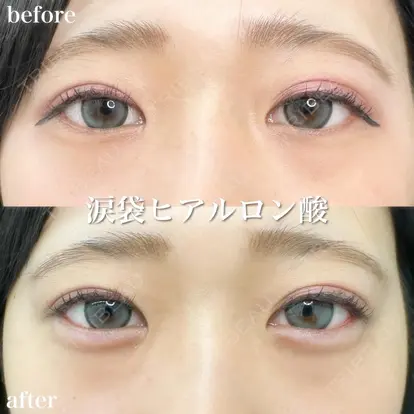 小松 正樹先生の症例