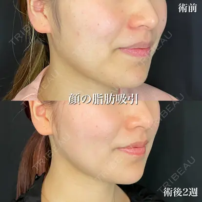 小松 正樹先生の症例