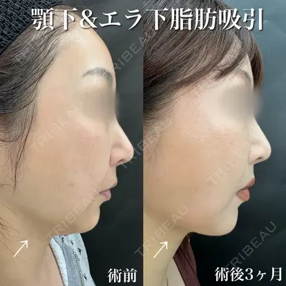 小松 正樹先生の症例