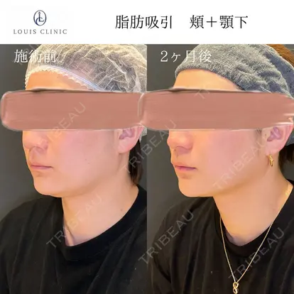 小松 塁先生の症例