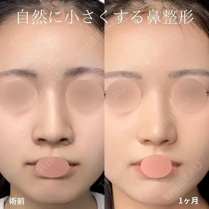 大阪院院長 羽根和秀先生の症例