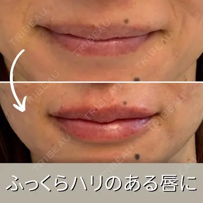 中島 ちかこ先生の症例