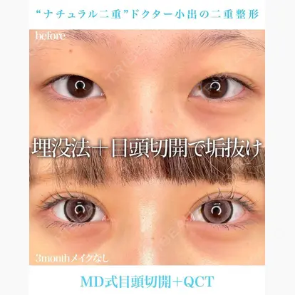 小出 真哉 ※現在指名不可先生の症例