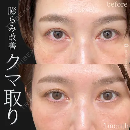 土門 一迅先生の症例