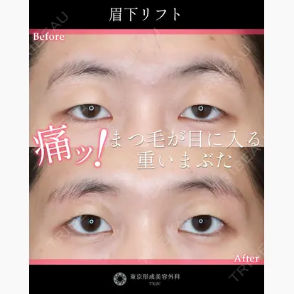 弓削田　浩主先生の症例