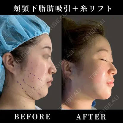 小山 麻衣先生の症例