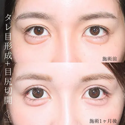 小川 杏平先生の症例