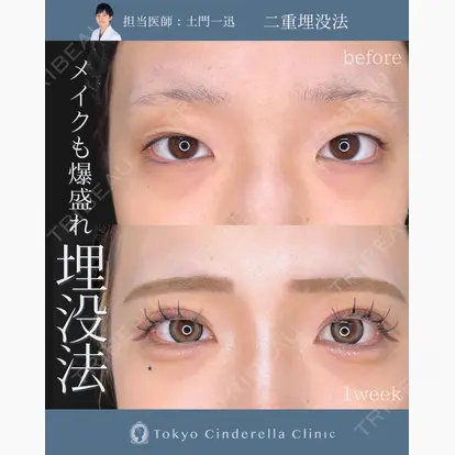 土門 一迅先生の症例