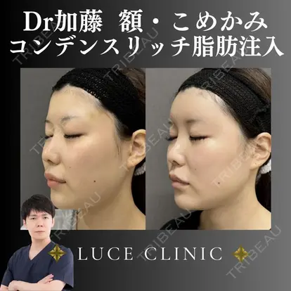 加藤晴之輔先生の症例