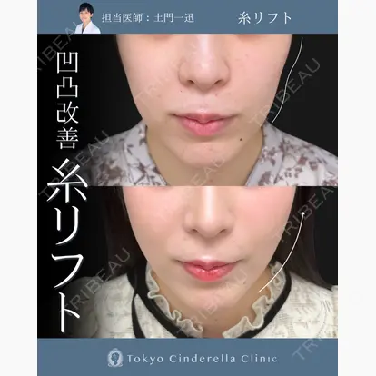 土門 一迅先生の症例