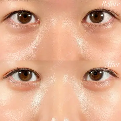 木村 尚大先生の症例